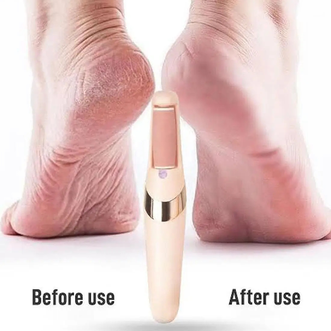 Rechargeable Electric Foot File Callus Remover for Wet & Dry Pedicure